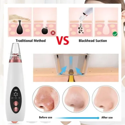 Electric Vacuum Electric Acne / Blackhead Remover Extractor 6 Suction Head Beauty Machine for Skin Care – Black Head Remover