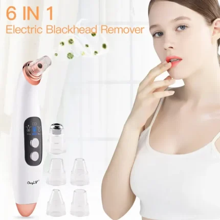 Electric Vacuum Electric Acne / Blackhead Remover Extractor 6 Suction Head Beauty Machine for Skin Care – Black Head Remover